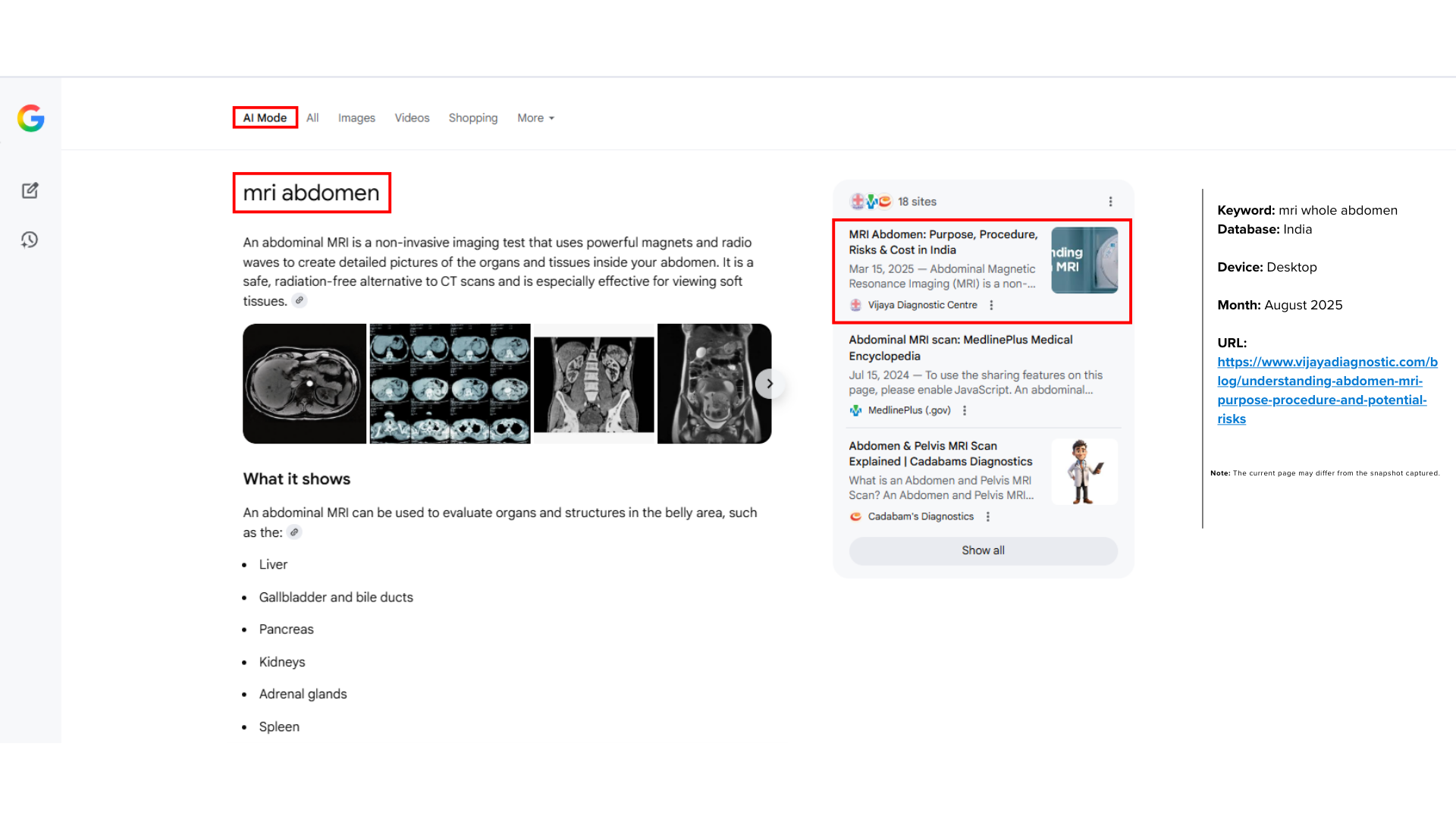 emiac-vijaya-diagnostic-centre-serp-overview-case-study